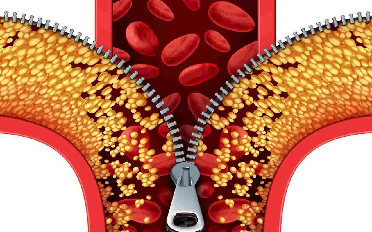 Colesterolo alto? Il metodo naturale per abbassarlo in 7 giorni Colesterolo alto? Il metodo naturale per abbassarlo in 7 giorni